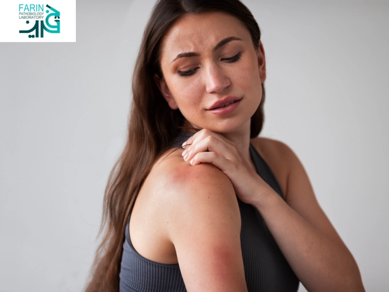 حساسیت پوستی چیست؟